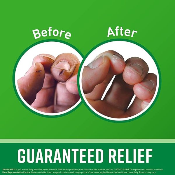 O'Keeffe's Giftbox Including Lip Repair with Cherry and Vitamin E Oil Stick, Working Hands Jar and Healthy Feet Jar - Image 2